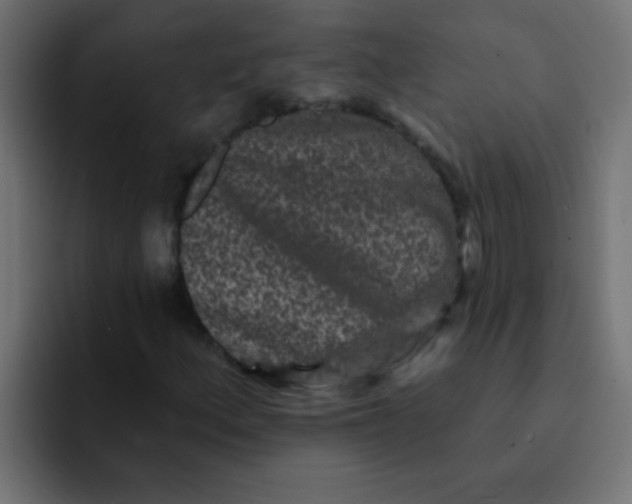 X0000092081156200710031131