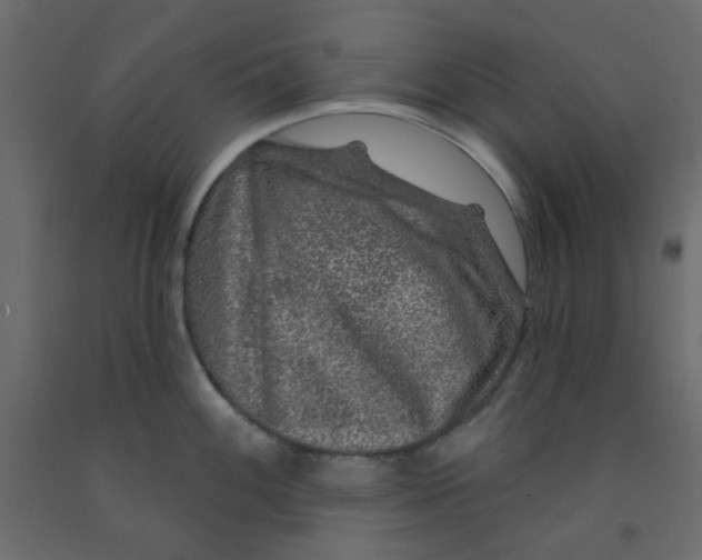 X0000092081100200710101035