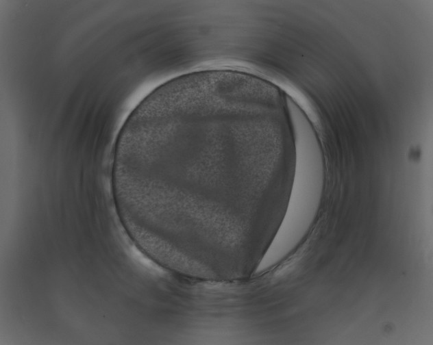 X0000092081102200710101035