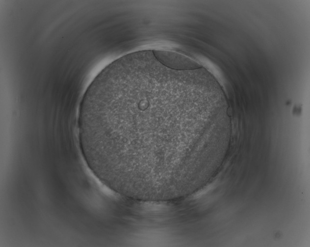 X0000092081103200710101035