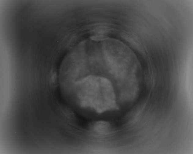 X0000092090087200710031202