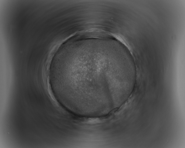 X0000092090097200710031201