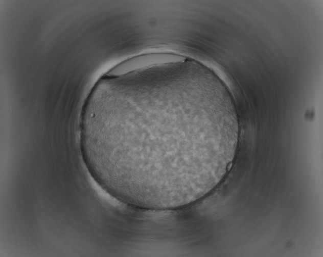 X0000092111143200710101138