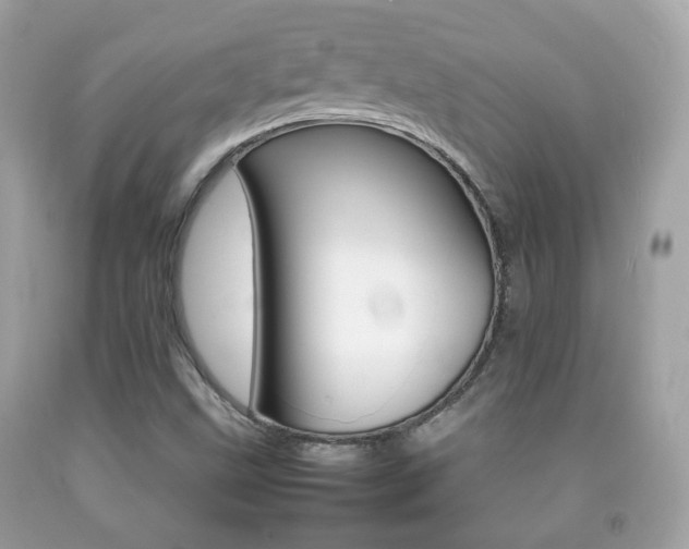 X0000092211499200709140851