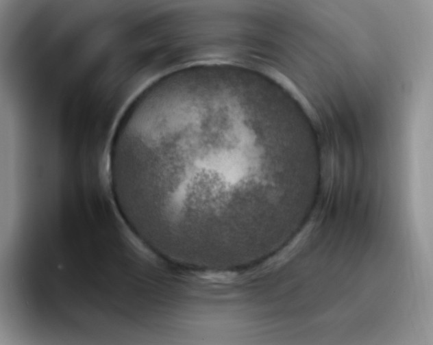 X0000092211466200709141017