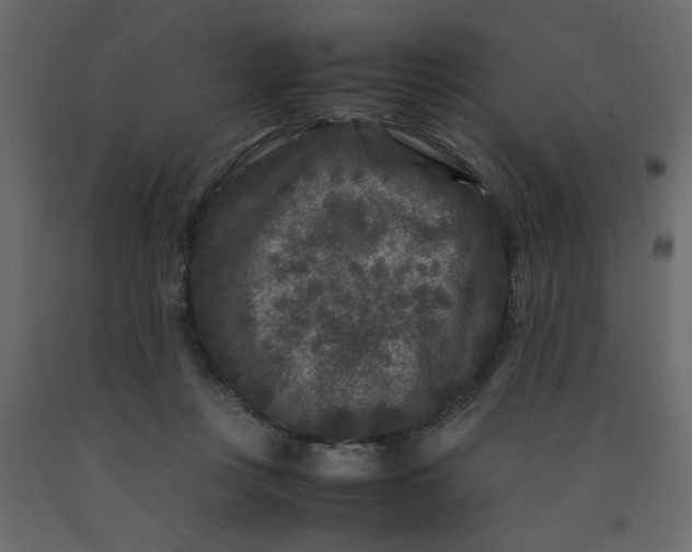 X0000092210359200710051141