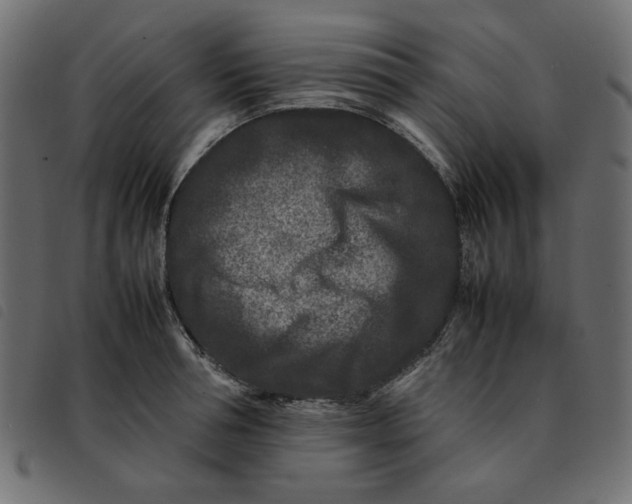 X0000092210994200710121125
