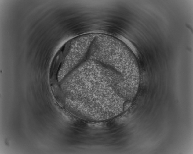 X0000092211051200710121125