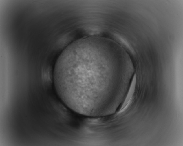X0000092220170200709211014
