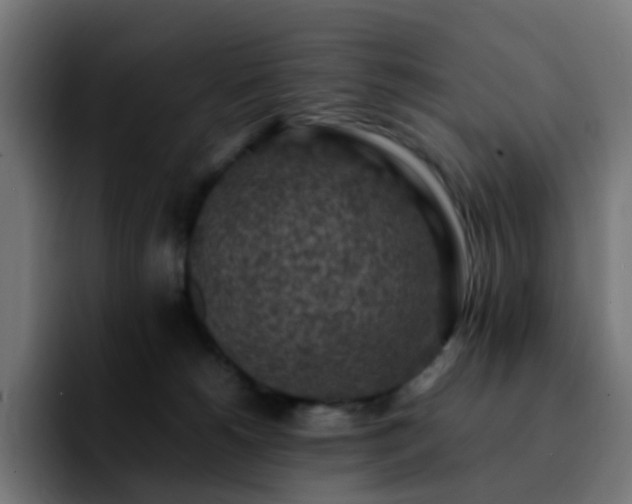 X0000092220180200709211014