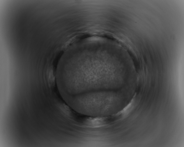 X0000092220186200709211014