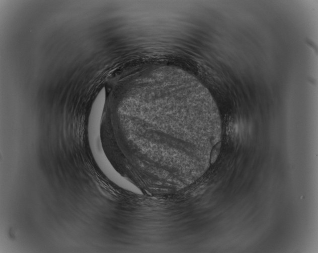 X0000092220868200710121155