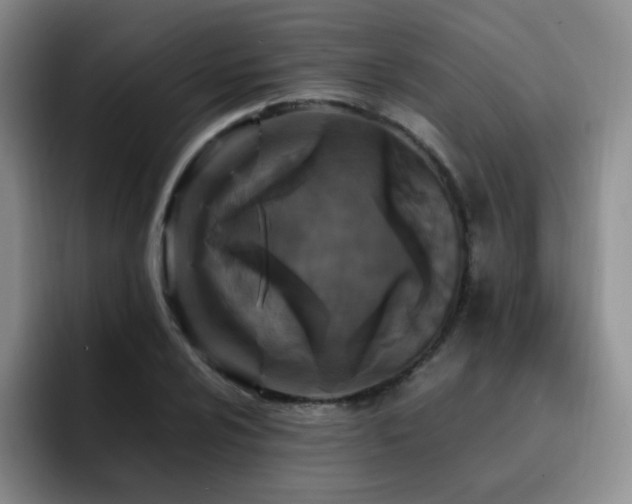 X0000092231024200709141102
