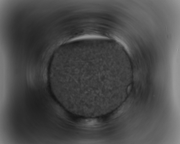 X0000092250353200709211105