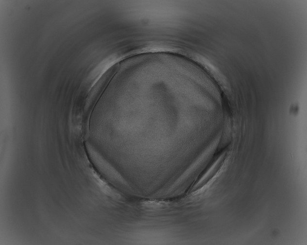 X0000092251185200710051253