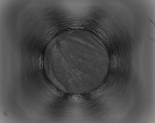X0000092250420200710121303
