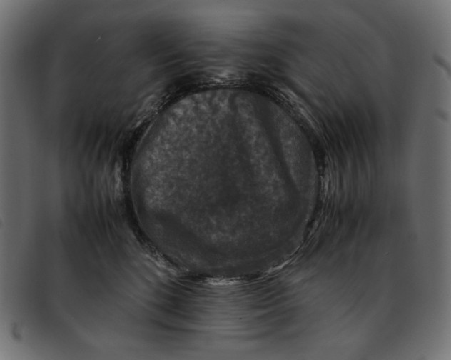 X0000092250520200710121302