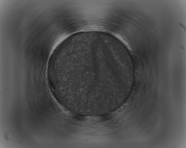 X0000092251469200710121249