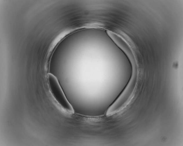 X0000092261196200709141020