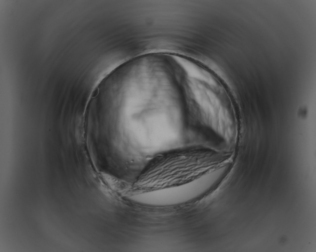 X0000092261145200710051314