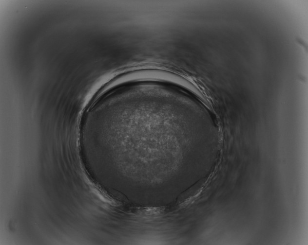 X0000092280056200710041418