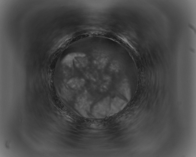 X0000092281399200710051135