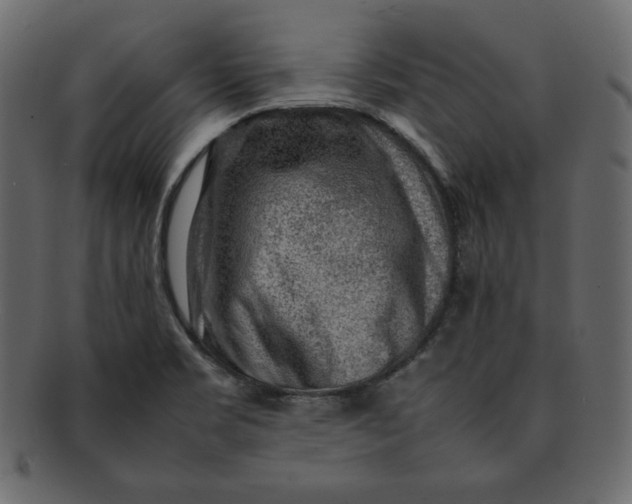 X0000092281469200710051134