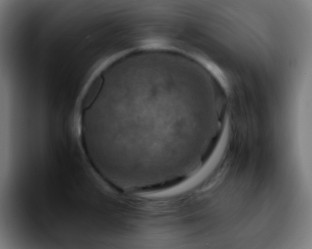 X0000092291376200709211205