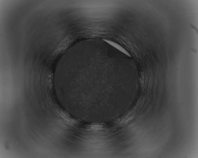 X0000092290462200710051205