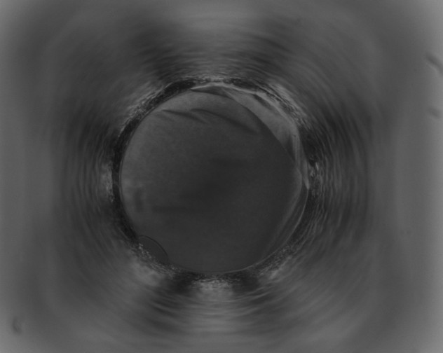 X0000092290500200710051204