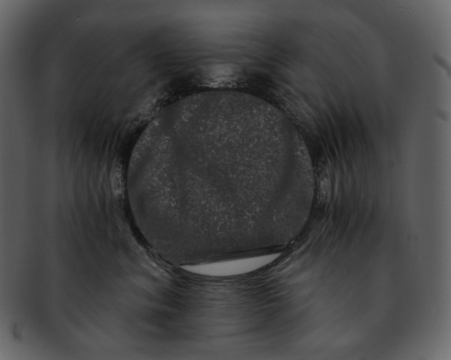 X0000092290620200710051203