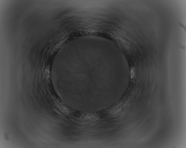 X0000092291011200710051158