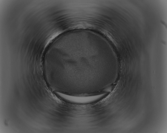 X0000092291018200710051158