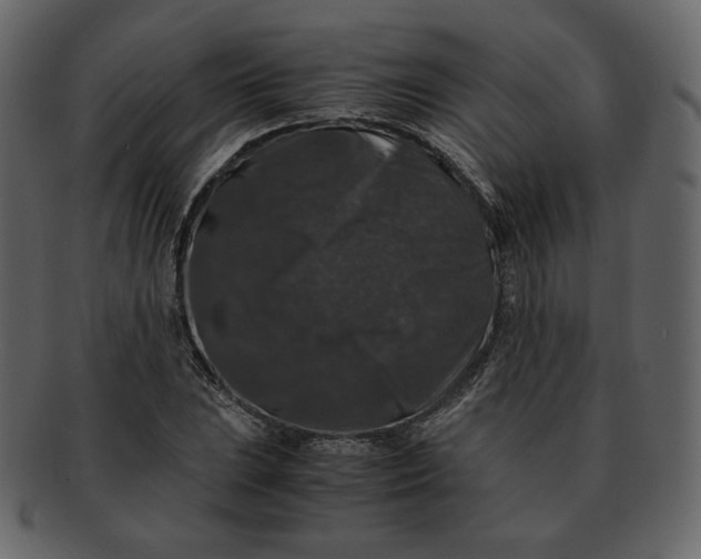 X0000092291023200710051158