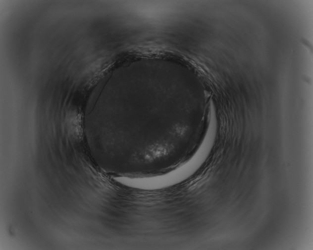 X0000092291156200710051156