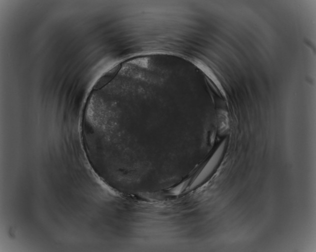 X0000092291197200710051156