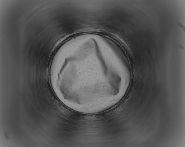 X0000092291220200710051156