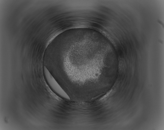 X0000092291417200710051153