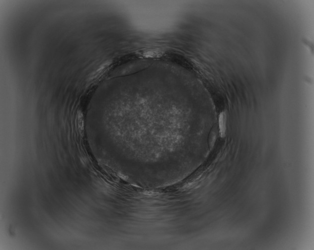 X0000092291443200710051153