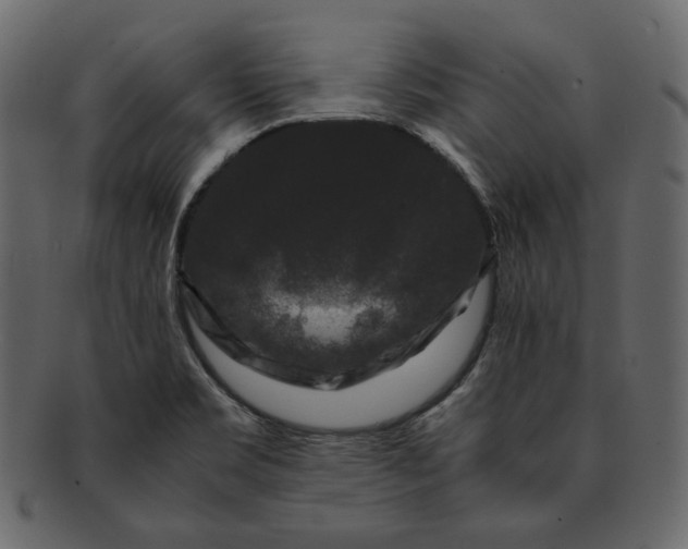 X0000092291469200710051153