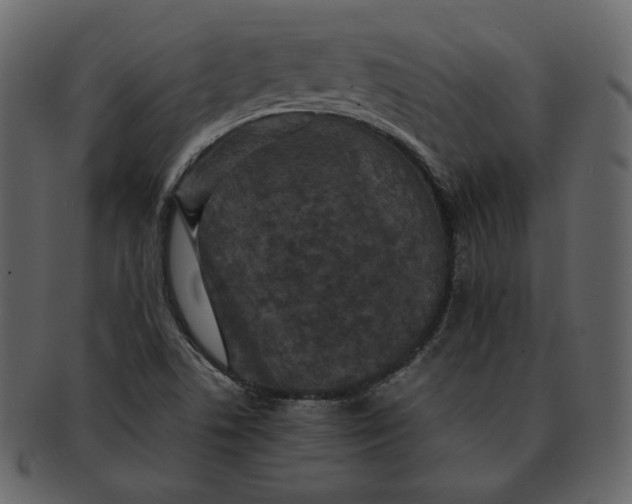 X0000092291506200710051152