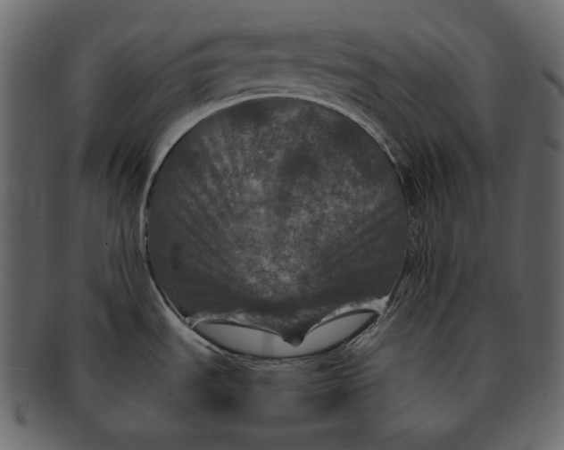 X0000092291535200710051152