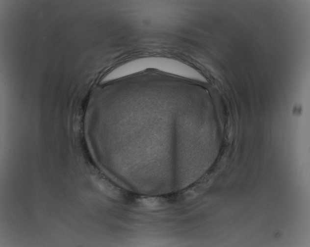 X0000092290417200710121438