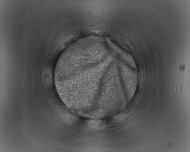 X0000092290615200710121435