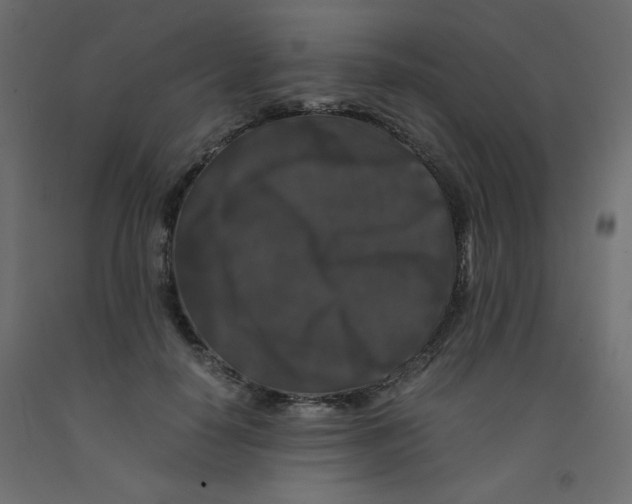 X0000092290650200710121435