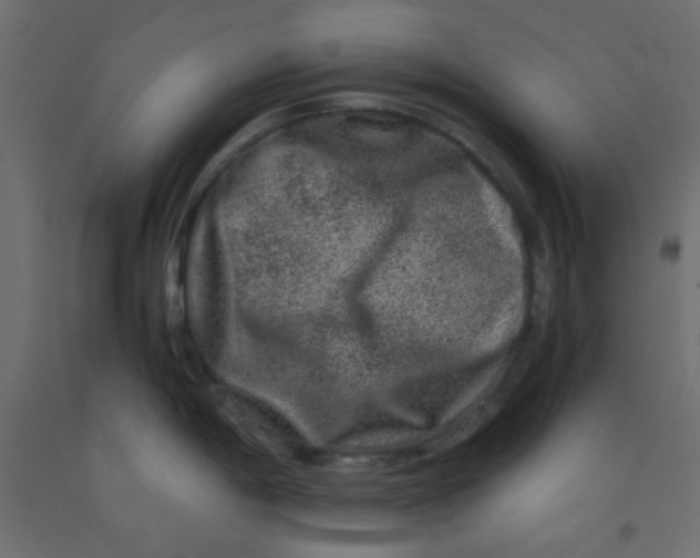 X0000092291198200710121427