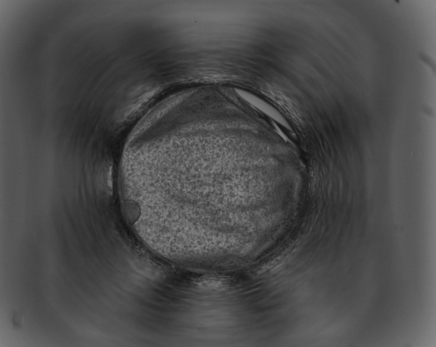 X0000092300358200710051224