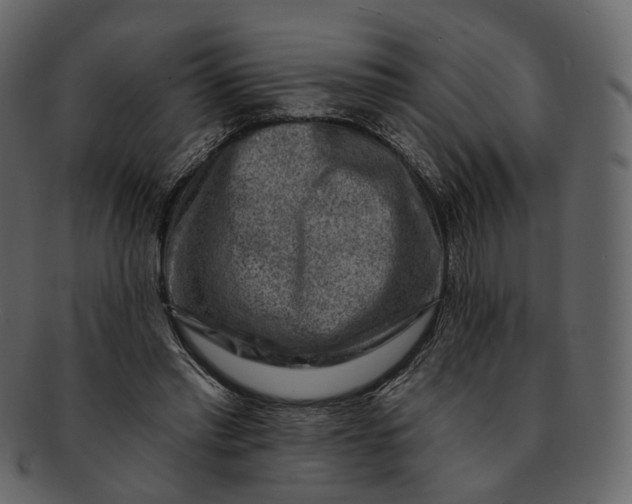 X0000092300397200710051224