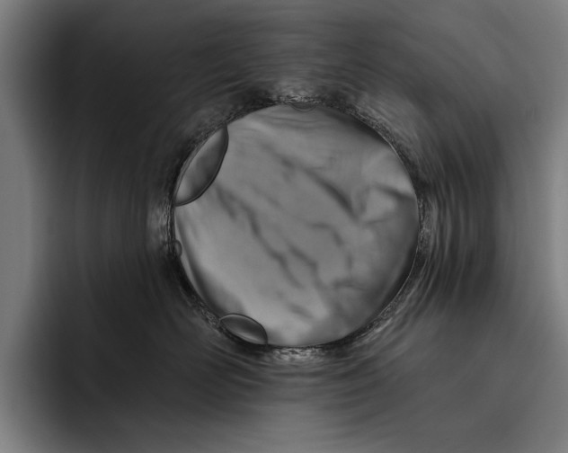 X0000092300526200710121449