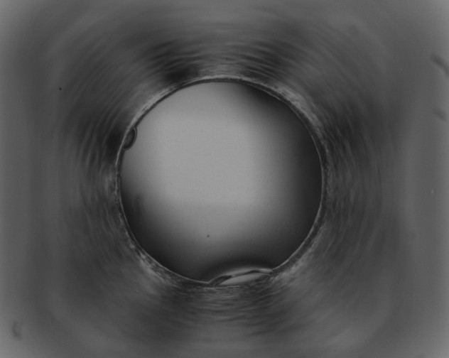 X0000092311145200710051234
